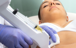 What you need to know about Mesotherapy