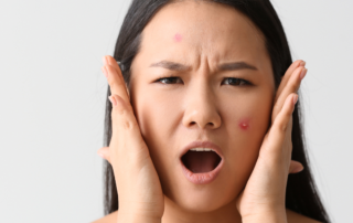 How to deal with stressed winter skin
