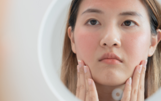Guide To Navigating Aesthetic Treatments With Sensitive And Reactive Skin