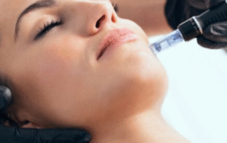 Discover The Future Of Skin Rejuvenation Polynucleotides And Exosomes Treatments Now Available In Dartford