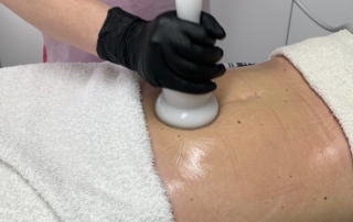 Body Contouring Explained Which Treatment Is Right For Your Body Goals