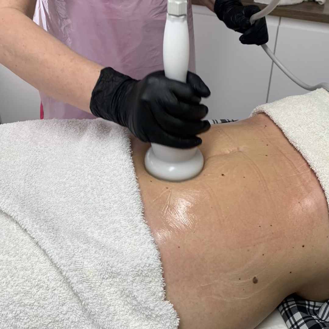 Body Contouring Explained Which Treatment Is Right For Your Body Goals Body Contouring Explained Which Treatment Is Right For Your Body Goals