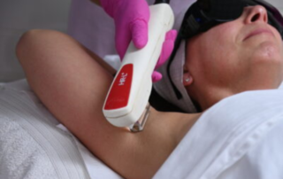 Laser Hair Removal Vs IPL Hair Removal What’s The Difference
