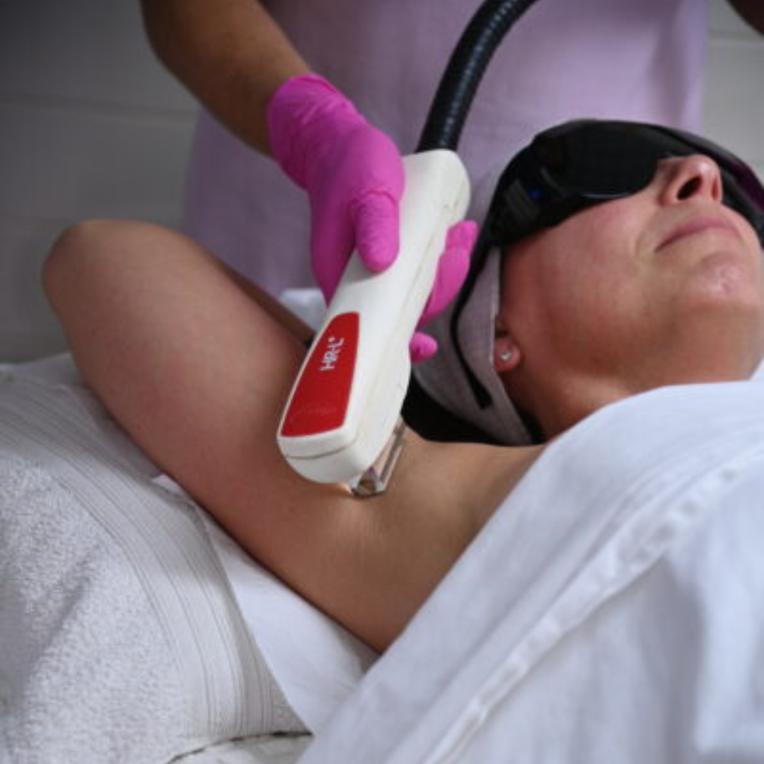 Laser Hair Removal Vs IPL Hair Removal What’s The Difference Laser Hair Removal Vs IPL Hair Removal What’s The Difference